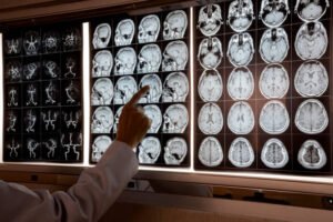 Doctor pointing at MRI of human brain on the light box to demonstrate anatomy